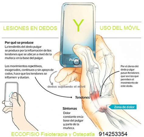 Fisioterapia Ensanche De Vallecas 91 4253354 Ecco Fisio