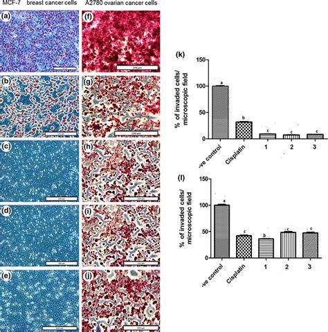 Qualitative Findings Of Cell Invasion Assay Illustrated By 13 Towards