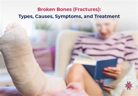 Broken Bones Fractures Types Causes Symptoms And Treatment Er