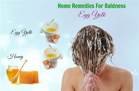 53 Natural Home Remedies For Baldness In Males And Females