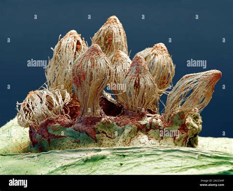 Rust Fungus Coloured Scanning Electron Micrograph Sem Of The