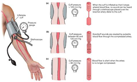 Blood Pressure Blood Flow Flashcards Quizlet