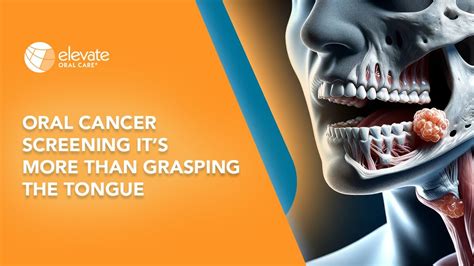 Oral Cancer Screening Its More Than Grasping The Tongue Youtube