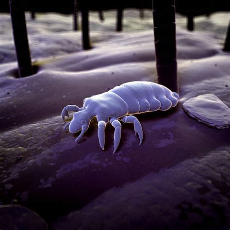 Piojo Humano Ilustraciones - Banco de fotos e imágenes de stock - iStock