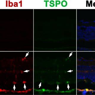 Double Immunolabeling For Iba1 And TSPO Fluorescence Photomicrographs