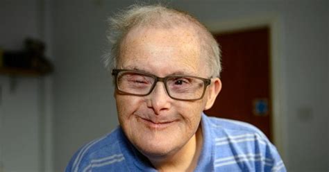 The Oldest Man With Down Syndrome Breaks Record By Turning 77 Years Old