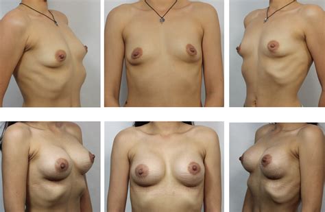 Different Shapes Of Breasts 74 Photos Porn Photo