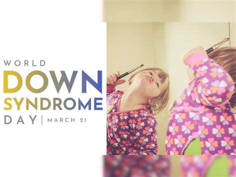 World Down Syndrome Day ट्राइसोमी 21 के नाम से भी जाना जाता है डाउन