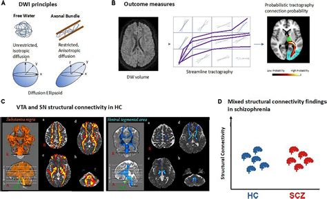 Frontiers Magnetic Resonance Imaging Of The Dopamine System In