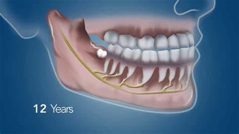 Wisdom Teeth Function Boston Dentist Congress Dental Group