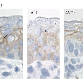 Representative Images Of Immunoperoxidase Localization Of Aqp In M