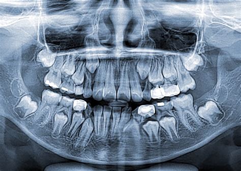 Tipos De Radiografías Dentales Araújo Smart Dental