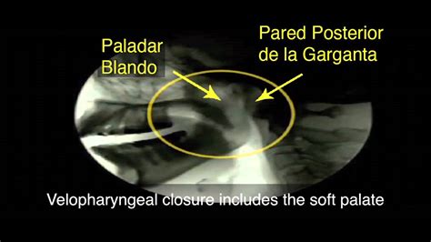 Thph Module 11 Introducción Anatomía Y Fisiología Del Paladar