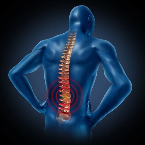 Paralysis & Spinal Cord Injury Attorneys in Jackson, MS - Brown, Bass ...