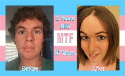 Mtf 2 Years Of Hrt 27 Years Old Before And After Imgur