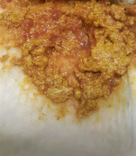 Mucus and Blood in Stool (pic) - Glow Community