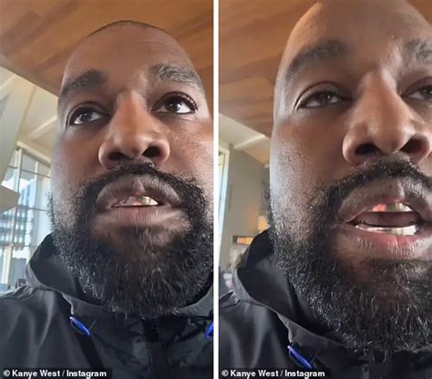 Kanye Preocupa Sus Fans Por Un ‘bulto En Su Labio Tras 1 Mes De Sus