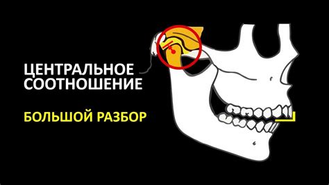 ЦЕНТРАЛЬНОЕ СООТНОШЕНИЕ БОЛЬШОЙ РАЗБОР - YouTube