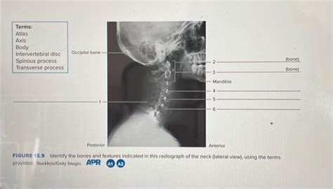 Solved Bone Bone Landible Enior Figure Identify The Chegg