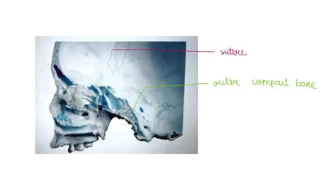 Solved Cortical Compact Bone Often Appears On Either Side Of A Layer