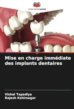 Buy Mise En Charge Immdiate Des Implants Dentaires Book Online At Low