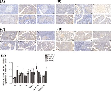 Expression Levels Of Beclin 1 Lc3 Ii Hif 1α And Pparγ In Pancreatic