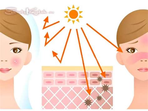 SPF: фактор защиты от солнца: 20, 30, 50 что это значит в косметике ...