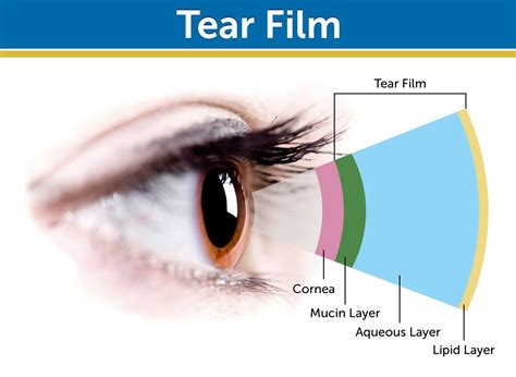 Dryeyecoach® On Twitter Understanding The Tear Film Is Key To Seeing