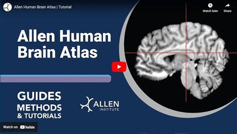 Allen Human Brain Atlas Youtube Tutorial Allen Human Brain Atlas