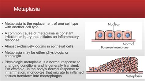 Metaplasia | Medical school essentials, Basement membrane, Nursing study