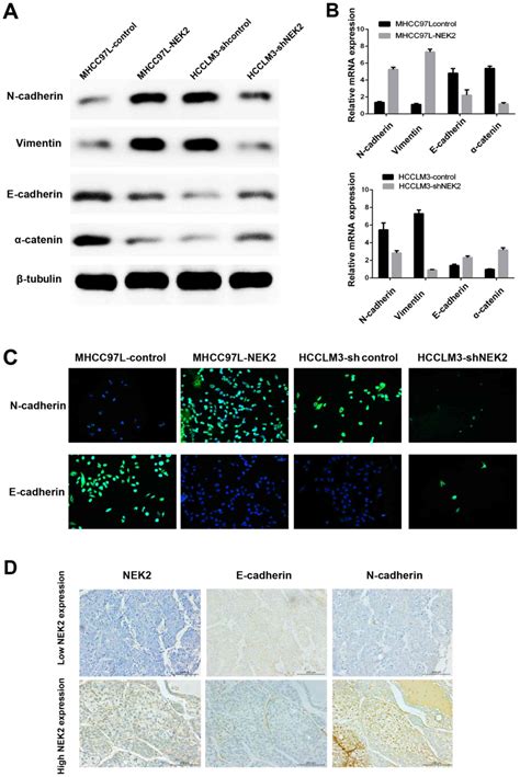 Nek Promotes Hepatocellular Carcinoma Migration And Invasion Through