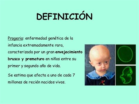 Progeria