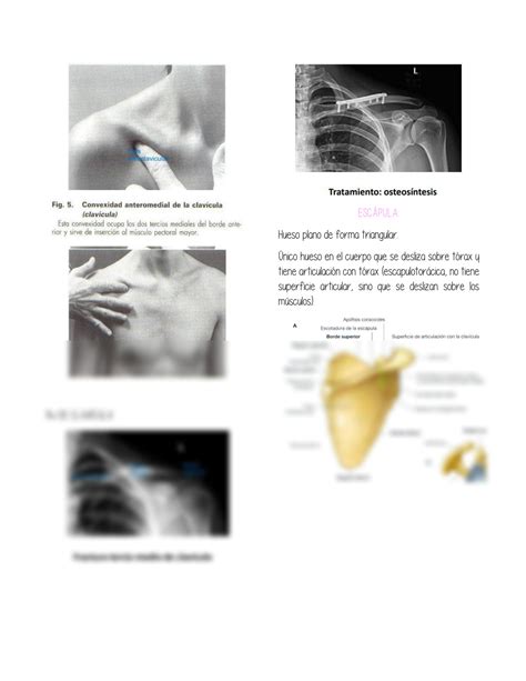 SOLUTION Osteolog A De Miembro Superior Studypool