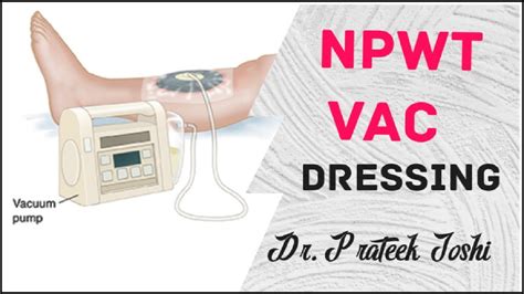 Negative Pressure Wound Therapy Vaccum Assisted Closure Vac