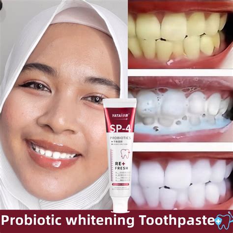 Toothpaste Ubat Gigi Teeth Whitening Probiotic Toothpaste Fresh Breath