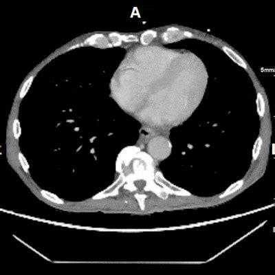 Computed Tomography CT 3D And Quantitative Imaging Laboratory