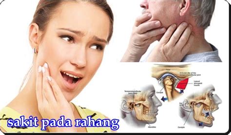 Rahang Sebelah Kiri Sakit Homecare24