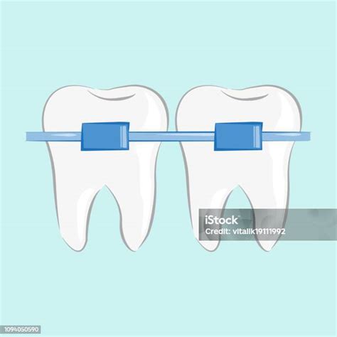 평면 스타일 벡터 일러스트 레이 션에에서 치아 교정기 개념에 대한 스톡 벡터 아트 및 기타 이미지 개념 건강관리와 의술