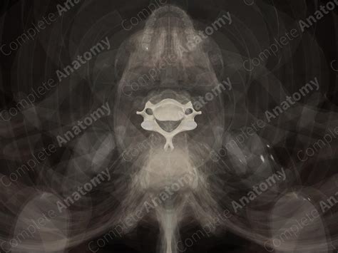 Sixth Cervical Vertebra Complete Anatomy