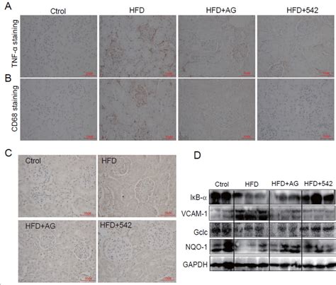 Figure S5 EGFR Inhibition Attenuates HFD Induced Inflammation And ROS