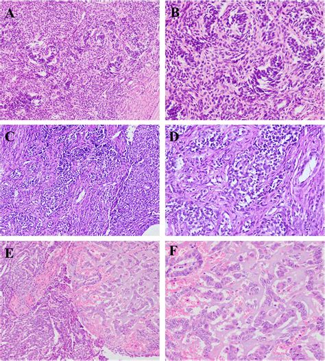 Hematoxylin Eosin Staining Pictures Of Lgess As And Chec A B Sex