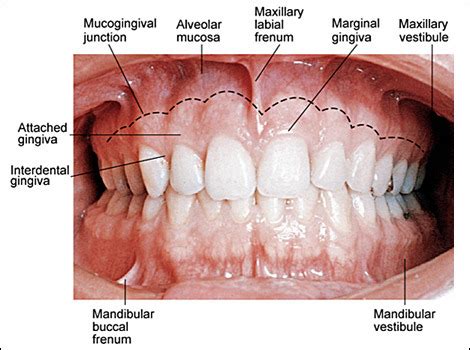 Gingival Tissue And Its Landmarks Diagram Quizlet