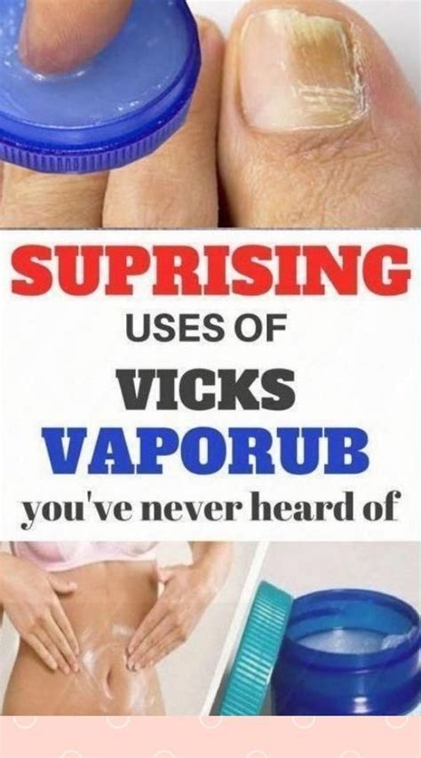 10 Unexpected Uses Benefits Of Vicks Vaporub Artofit