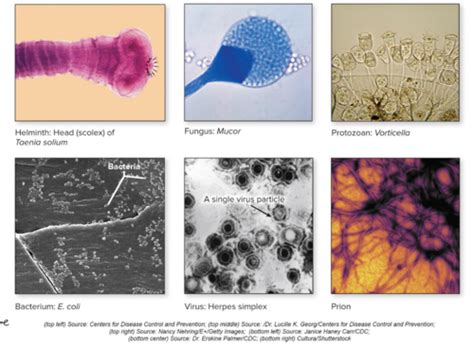 Microbiology Introduction To Microbiology Flashcards Quizlet