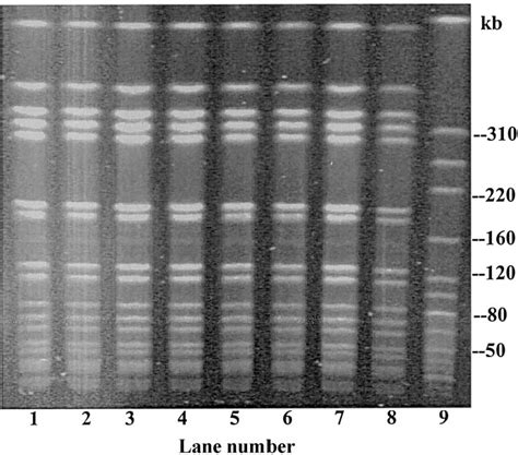 Figure 2 From Hospital Transmission Of Community Acquired Methicillin