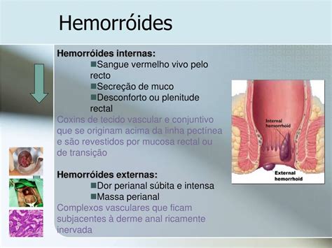 Ppt Patologia Perianal Powerpoint Presentation Free Download Id 829116