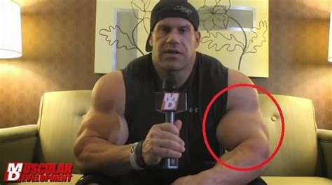 Pro Bodybuilders Using Synthol Strength Fighter