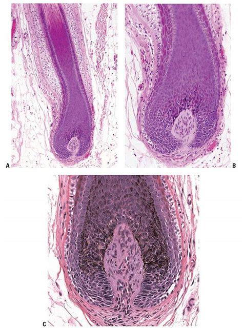 Normal Hair Follicle Histology