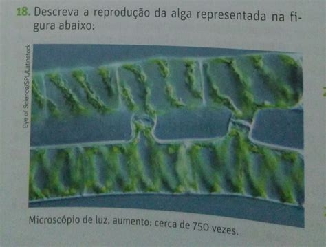 Cromatina Dna Protoctistas Exercícios