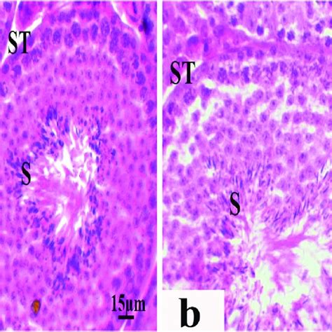 A Photomicrograph Of Section Of Testis Of Control Rat Showing Normal